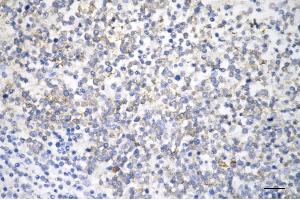 Immunohistochemistry was performed on paraffin-embedded human tonsillitis using CD45 antibody (ABIN7800044), 1:100).