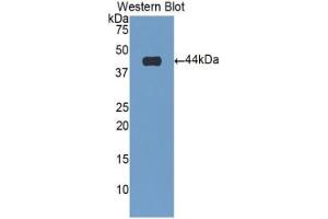 Western blot analysis of the recombinant protein. (Cardiac Troponin T2 Antikörper  (AA 2-100))