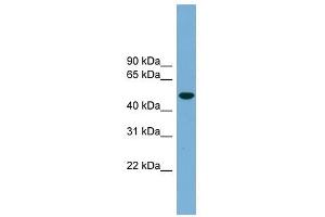 Ubiquilin-Like antibody used at 1 ug/ml to detect target protein. (UBQLNL Antikörper  (Middle Region))