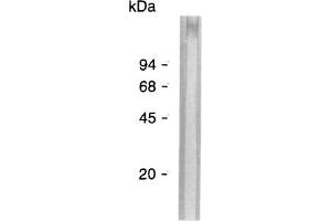 Western Blot analysis of ABIN125762 specificity. (Aggregation Factor Antikörper)