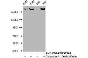 Western Blot Positive WB detected in A549 whole cell lysate,293 whole cell lysate(treated with Calyculin A or EGF) All lanes Phospho-MTOR antibody at 1. (Rekombinanter MTOR Antikörper  (pSer2481))