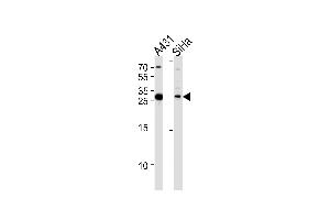 HSD17B12 Antibody (Center) (ABIN653300 and ABIN2842802) western blot analysis in A431,SiHa cell line lysates (35 μg/lane).