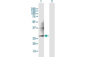 Western Blot analysis of PMM2 expression in transfected 293T cell line ( H00005373-T01 ) by PMM2 MaxPab polyclonal antibody. (PMM2 Antikörper  (AA 1-246))