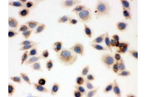 ICC testing of FFPE human SMMC-7721 cells with BAK antibody. (BAK1 Antikörper  (AA 22-211))