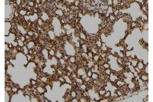ABIN6273575 at 1/100 staining Mouse lung tissue by IHC-P. (ZNF768 Antikörper  (Internal Region))