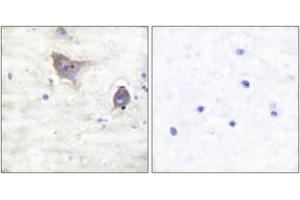 Immunohistochemistry analysis of paraffin-embedded human brain tissue, using Synuclein beta Antibody.