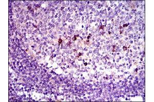 Immunohistochemistry (IHC) image for anti-Transforming Growth Factor, beta 1 (TGFB1) (AA 62-195) antibody (ABIN969570)