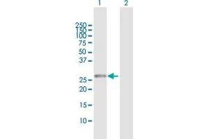 Western Blot analysis of RAB23 expression in transfected 293T cell line by RAB23 MaxPab polyclonal antibody. (RAB23 Antikörper  (AA 1-237))