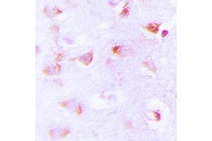 Immunohistochemistry (IHC) image for anti-Acetyl-CoA Carboxylase alpha (ACACA) (N-Term), (pSer80) antibody (ABIN7300308)