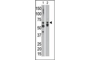 The anti-MTM1 C-term Pab is used in Western blot to detect MTM1 in NCI-H460 cell lysate (lane 1) and in mouse heart tissue lysate (lane 2). (MTM1 Antikörper  (C-Term))
