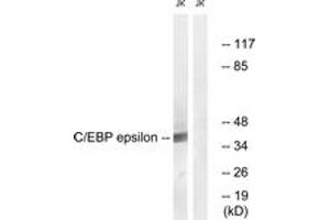 Western blot analysis of extracts from JurKat cells, treated with Insulin 0. (CEBPE Antikörper  (AA 40-89))