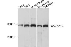 Western blot analysis of extracts of various cell lines, using CACNA1E antibody.