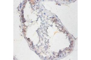 Immunohistochemistry of paraffin-embedded human testis tissue using ABIN7170460 at dilution of 1:100 (SMCP Antikörper  (AA 1-116))