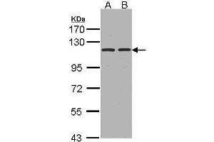 WB Image Sample(30 ug whole cell lysate) A:Hep G2 , B:HeLa S3, 7. (ENPEP Antikörper  (C-Term))