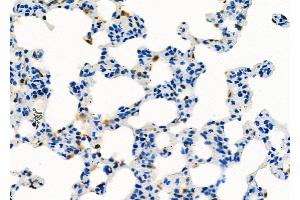 ABIN6260031 and ABIN6273193 at 1/100 staining Rat lung tissue by IHC-P. (ARHGDIB Antikörper  (N-Term))