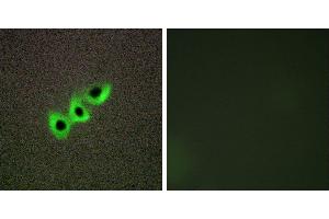 Peptide - +Immunohistochemistry analysis of paraffin-embedded human prostate carcinoma tissue, using RHG07 antibody. (DLC1 Antikörper)