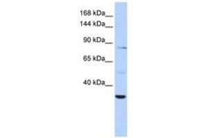 Image no. 1 for anti-AHNAK Nucleoprotein 2 (AHNAK2) (C-Term) antibody (ABIN6743126) (AHNAK2 Antikörper  (C-Term))