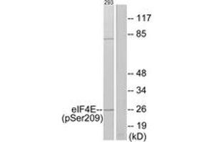 Western blot analysis of extracts from 293 cells treated with Anisomycin 25ug/ml 30', using eIF4E (Phospho-Ser209) Antibody. (EIF4E Antikörper  (pSer209))