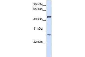 WB Suggested Anti-TMEM127 Antibody Titration:  0. (TMEM127 Antikörper  (Middle Region))