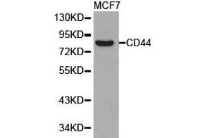 Western Blotting (WB) image for anti-CD44 (CD44) antibody (ABIN1871637) (CD44 Antikörper)