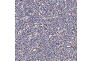 IHC analysis of CD74 using anti-CD74 antibody (ABIN7602385). (CD74 Antikörper  (AA 73-296))