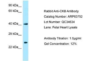 Western Blotting (WB) image for anti-Creatine Kinase, Brain (CKB) (N-Term) antibody (ABIN2789612)
