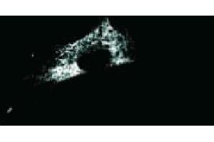 Immunoflourescence staining of the human lung cell line, WI38. (Calreticulin Antikörper  (AA 270-390))
