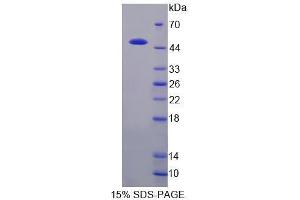 Image no. 1 for Casein kappa (CSN3) (AA 22-190) protein (His tag,GST tag) (ABIN6237587)