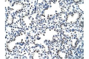 HNRPLL antibody was used for immunohistochemistry at a concentration of 4-8 ug/ml to stain Alveolar cells (arrows) in Human Lung. (HNRPLL Antikörper  (N-Term))