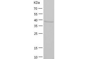 Western Blotting (WB) image for Guanine Nucleotide Binding Protein (G Protein), Q Polypeptide (GNAQ) (AA 1-359) protein (His tag) (ABIN7286332) (GNAQ Protein (AA 1-359) (His tag))