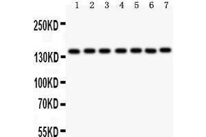 Western Blotting (WB) image for anti-Poly (ADP-Ribose) Polymerase 1 (PARP1) (AA 670-858) antibody (ABIN3043378) (PARP1 Antikörper  (AA 670-858))