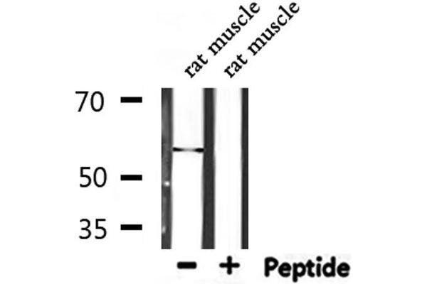 Tryptophan Hydroxylase 1 Antikörper  (Internal Region)