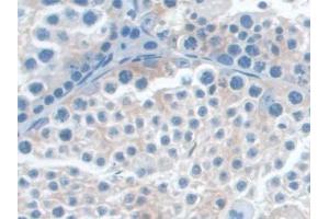 IHC-P analysis of Mouse Testis Tissue, with DAB staining. (MAP4 Antikörper  (AA 882-1062))