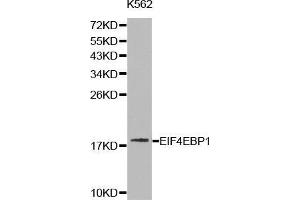 Western blot analysis of K562 cell lysate using EIF4EBP1 antibody. (eIF4EBP1 Antikörper  (C-Term))