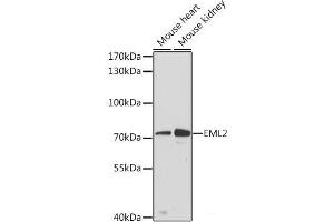Western blot analysis of extracts of various cell lines using EML2 Polyclonal Antibody at dilution of 1:3000. (EML2 Antikörper)