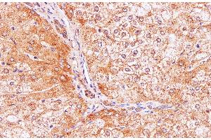 Immunohistochemistry of paraffin-embedded Human liver using IL2 Polyclonal Antibody at dilution of 1:100 (IL-2 Antikörper)