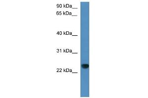 WB Suggested Anti-Capsl Antibody Titration: 0. (CAPSL Antikörper  (C-Term))