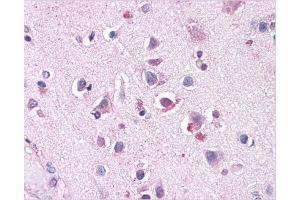 Immunohistochemical staining of Skeletal Muscle using AP31144PU-N SLC29A1 antibody (SLC29A1 Antikörper  (Internal Region))