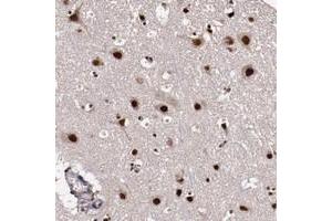 Immunohistochemical staining of human cerebral cortex with CECR2 polyclonal antibody  shows strong nuclear and cytoplasmic positivity in neuronal cells.