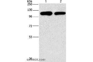 Western blot analysis of A431 and hela cell, using PIP5K1C Polyclonal Antibody at dilution of 1:500 (PIP5K1C Antikörper)