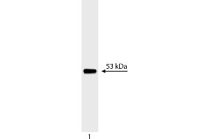 Western Blotting (WB) image for anti-Tumor Protein P53 (TP53) (AA 14-289) antibody (ABIN967419) (p53 Antikörper  (AA 14-289))