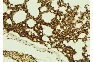 ABIN6273100 at 1/100 staining Mouse lung tissue by IHC-P. (CHMP4B Antikörper  (N-Term))