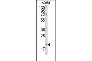 Image no. 1 for anti-Bcl2 Modifying Factor (BMF) (AA 130-150), (BH3 Domain) antibody (ABIN356819) (BMF Antikörper  (BH3 Domain))