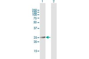 Western Blot analysis of PSMA6 expression in transfected 293T cell line by PSMA6 MaxPab polyclonal antibody. (PSMA6 Antikörper  (AA 1-246))