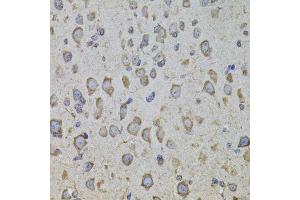 Immunohistochemistry of paraffin-embedded mouse brain using CRHR1 antibody. (CRHR1 Antikörper  (AA 24-120))