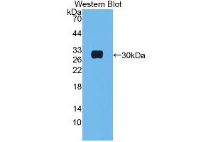 Western blot analysis of the recombinant protein. (MBL2 Antikörper  (AA 19-244))