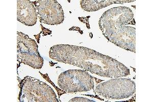 IHC analysis of COMT using anti-COMT antibody (ABIN7601948). (COMT Antikörper  (AA 52-271))