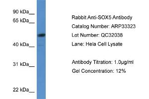 WB Suggested Anti-SOX5 Antibody Titration:  0. (SOX5 Antikörper  (C-Term))