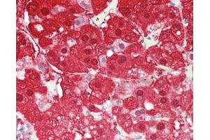 Immunohistochemistry (Paraffin-embedded Sections) (IHC (p)) image for anti-Aldo-Keto Reductase Family 1, Member B10 (Aldose Reductase) (AKR1B10) (AA 1-316) antibody (ABIN2738213)