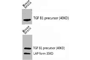 Western Blot analysis of mouse-brain using TGFβ1 Polyclonal Antibody. (TGFB1 Antikörper  (C-Term))